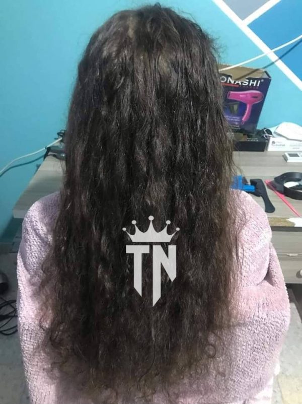 la cystéine gold thérapie